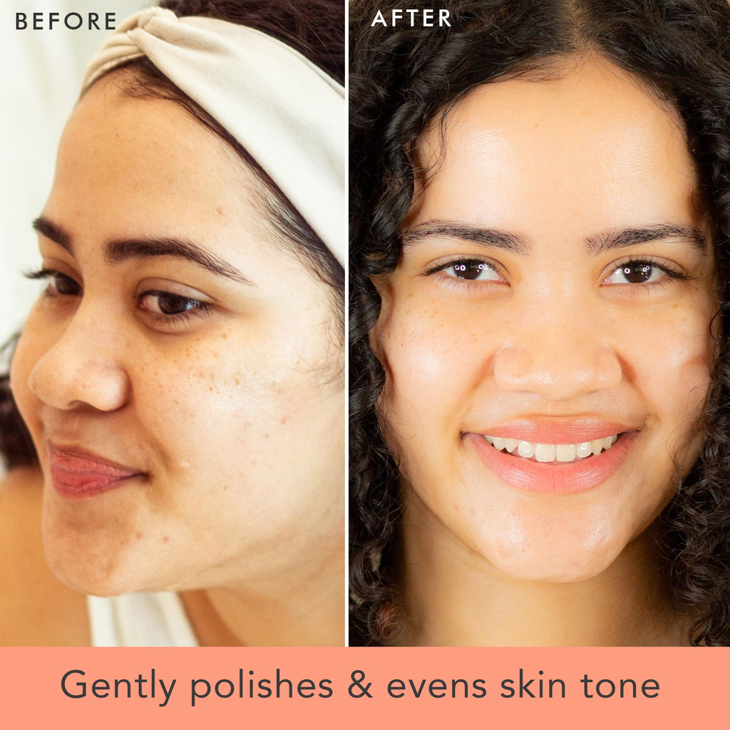 Facial Scrub Exfoliator - USA Made with Natural & Organic Ingredients, Gentle Exfoliating Face Wash for Sensitive & Acne Prone Skin, Microdermabrasion Scrub, Removes Dead Skin Cells (2 Fl Oz)